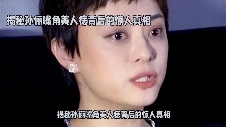 新澳天天彩2025芳草地和孙俪唇下痣没了与孙俪嘴唇的痣